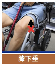 膝下垂
